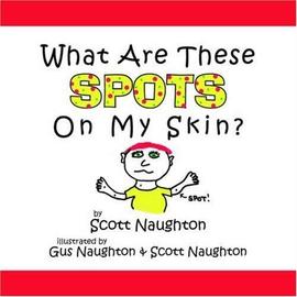 What Are These Spots On My Skin? - Scott Naughton