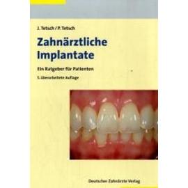 Zahnärztliche Implantate - Jan Tetsch